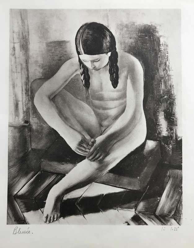 Moïse Kisling (French, born Poland, 1891 – 1953) Blessée DATE1928 MEDIUMLithograph on paper DIMENSIONSImage: 7 13/16 × 6 1/4 in. (19.8 × 15.9 cm) Sheet: 11 × 8 15/16 in. (27.9 × 22.7 cm) CREDIT LINEGeorgia Museum of Art, University of Georgia; Gift of Richard E. and Lynn R. Berkowitz OBJECT NUMBER2020.52